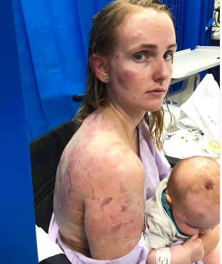 Mae se Coloca Como Escudo para Salvar Seu Filho da Tempestade